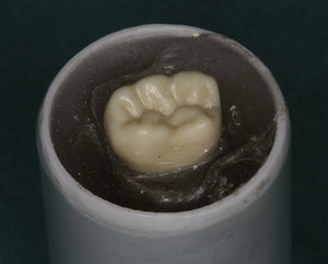 Simulated occlusal table of 120° without PDL‐simulator (rigid model).