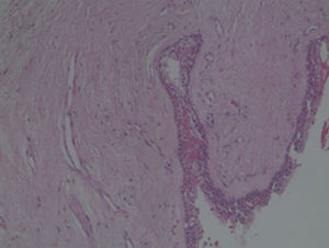 Histologic feature of biopsy specimen (Haematoxylin–eosin stain) – 20×.