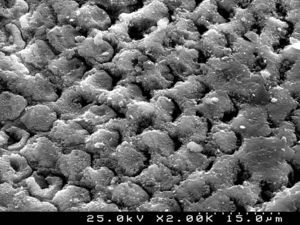 SEM photograph of a conditioned enamel surface with Transbond™Plus Self Etching Primer observed at ×1500.