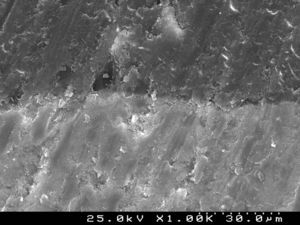 SEM photograph of resin–enamel interfaces with Heliosit® Orthodontic (G4) observed at ×1000.
