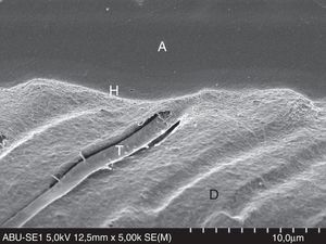 FESEM micrograph of a resin–dentin interface formed with All-Bond Universal Adhesive (Bisco Inc.), applied in self-etch mode. Note the thinner hybrid layer (H) and narrow resin tags (T). Original magnification=×5000. A=adhesive; D=dentin; H=hybrid layer; T=resin tag.