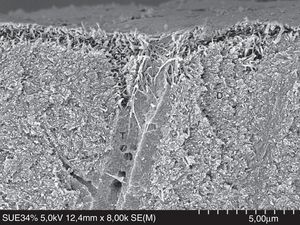 FESEM micrograph of human dentin etched with 32% phosphoric acid (3M ESPE) for 15s. Original magnification=×8000. CF=collagen fibrils exposed by the acid; D=dentin; T=dentinal tubule.