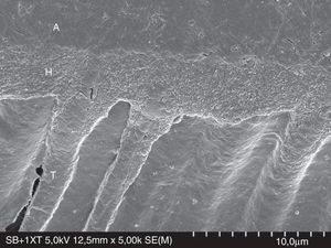 FESEM micrograph of resin–dentin interface formed with the ethanol/water-based etch-and-rinse adhesive Adper Scotchbond 1XT (3M ESPE) following the ‘wet-bonding technique’. Original magnification=×5000. A=adhesive; H=hybrid layer; T=resin tag.