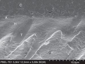 FESEM micrograph of a resin–dentin interface formed with the acetone-based Prime&Bond Elect Universal Adhesive (Dentsply Caulk) applied as an etch-and-rinse adhesive. Note the thin adhesive layer (A) than that of the Adper Scotchbond 1XT (3M ESPE) in Fig. 8. Original magnification=×5000. A=adhesive; C=composite; D=dentin; H=hybrid layer; T=resin tag.