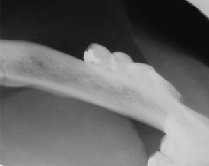 Imagem radiográfica oclusal distorcida de mandíbula.