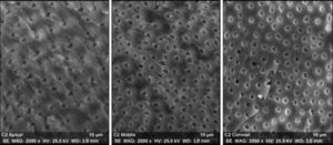 Imagens de MEV representativas da validação da desinfeção mecânico‐química nos terços apical, médio e coronário, com uma ampliação de 2.000×.