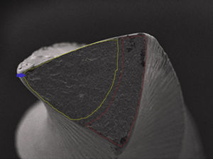 Microfotografia da superfície de fratura de lima Hyflex com a origem da fenda (seta), zona de propagação (tracejado amarelo) e zona de fratura final (tracejado vermelho).