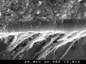 SEM image illustrating the dentin/resin interface of Clearfil™ Protect Bond (2500×).