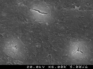 SEM representative image illustrating the smear layer covered dentin surface (6000×).