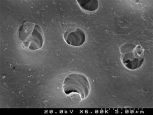 SEM representative image illustrating the “conditioned” dentin surface after treatment with 36% phosphoric acid (6000×).