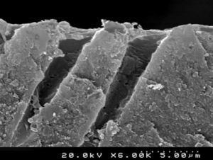 SEM representative image illustrating the “conditioned” dentin after treatment with 36% phosphoric acid (cross-sectional view; 6000×).