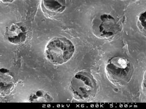 SEM representative image illustrating the “conditioned” dentin surface after treatment with Clearfil™ Protect Bond primer (6000×).