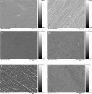 Scanning electronic photomicrographs showing a rougher surface for Evolu-X resin. (A) EVO+SP; (B) EVO+PTDV; (C) EVO+SP+FP; (D) EVO+PTDV+FP; (E) EVO+SP+SCB; (F) EVO+PTDV+SCB.
