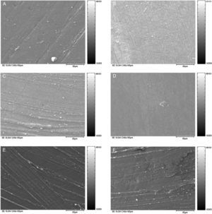 Scanning electronic photomicrographs showing a rougher surface for Durafill VS resin. (A) DUR+SP; (B) DUR+PTDV; (C) DUR+SP+FP; (D) DUR+PTDV+FP; (E) DUR+SP+SCB; (F) DUR+PTDV+SCB.