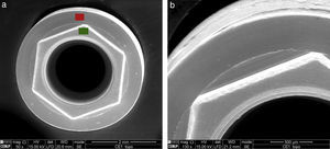 SEM photograph of the connection of BNT® S4 implants (a) with 45× and (b) 130× magnification, from an upper view. Red mark – top region, green mark – base region.