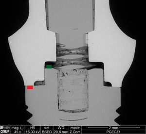 SEM photograph of the sagittal plane of the abutment/implant assembly, with 45× magnification, for observing the 3D profilometry reading areas.