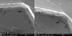 SEM image of the vertex of the implant