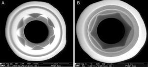 SEM photograph of the zirconia abutments’ connections for Aurea® RP (internal connection) (A) and BNT® S4 (external connection) (B) implants.