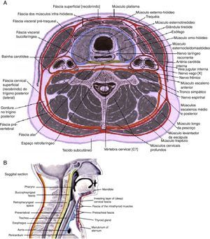 Fáscias cervicais. A: espaços cervicais profundos, esquema de corte axial. B: espaços cervicais profundos, esquema de corte sagital. Fonte: Atlas digital, J. Netter23. As fáscias cervicais e as suas subdivisões determinam a formação de espaços virtuais, conhecidos como espaços cervicais profundos (ECP), normalmente úteis para o deslizamento dos vários constituintes do pescoço, durante os seus movimentos. As fáscias podem ser divididas em fáscia cervical superficial (FCS) e fáscia cervical profunda (FCP). A FCS é constituída por tecido celular subcutâneo que se estende da região zigomática até ao tórax e axilas e envolve, em sua espessura, os músculos da expressão facial e o platisma. Essa fáscia é separada da FCP por um espaço virtual onde há gânglios, nervos e vasos, destacando‐se a veia jugular externa. A FCP é comumente subdividida em 3 camadas: superficial, média e profunda. A camada superficial da FCP (CSFCP) circunda totalmente o conjunto dos elementos constituintes do pescoço e delamina‐se para envolver, bilateralmente, os músculos esternocleidomastoideo, trapézio e as glândulas parótida e submandibular. A camada média da FCP (CMFCP) envolve os músculos pré‐tiroideus, esôfago, faringe, laringe, traqueia e glândula tiroide. É, por esse motivo, subdividida em 2 porções: muscular e visceral. A camada profunda da FCP, da mesma forma que a camada superficial, forma um revestimento completo da região, porém mais profundo, recobrindo os músculos escalenos, elevador da omoplata e esplénio da cabeça. É subdividida em 2 camadas denominadas fáscia pré‐vertebral e fáscia alar. É sobre a CPFCP que se encontram os elementos do feixe vásculo‐nervoso do pescoço e o nervo frénico. Os ECP são espaços formados entre as fáscias cervicais ou suas divisões, e podem ser divididos em espaços supra‐hioideus, infra‐hioideus e espaços localizados ao longo de todo o pescoço. Acima do osso hioide, bilateralmente, temos os seguintes: espaço submandibular, subdividido em espaços submaxilar e sublingual, separados pelo músculo milo‐hioideo; espaço mastigador, onde encontramos o ramo ascendente da mandíbula, o músculo masseter, a musculatura pterigóidea e porção inferior do músculo temporal; espaço parotídeo, bilateralmente, que contém a glândula parótida, o nervo facial e seus ramos, e os gânglios linfáticos profundos da região; espaço parafaríngeo, bilateralmente, subdividido em porções pré‐estilóideia e pós‐estilóideia, separadas pelo músculo tensor do véu palatino no nível da nasofaringe e pelo constritor da faringe no nível da orofaringe. O único ECP localizado exclusivamente abaixo do osso hioide é o espaço visceral anterior ou compartimento visceral do pescoço, formado pelas 3 camadas da FCP, onde estão contidas a glândula tiroide, a laringe, a faringe, a traqueia e o esôfago cervical. Entre os espaços situados ao longo de todo o pescoço distinguem‐se: o espaço retro‐faríngeo, localizado entre a divisão visceral da CMFCP (posterior à faringe e ao esófago) e a fáscia alar da CPFCP. Esse espaço tem seu limite superior ao nível da base do crânio e seu limite inferior ao nível da 1.a ou 2.a vértebra torácica; o chamado danger space, imediatamente posterior ao espaço retro‐faríngeo, localizado entre a fáscia alar da CPFCP e a fáscia pré‐vertebral da CPFCP, estendendo‐se da base do crânio até ao nível do diafragma; o espaço pré‐vertebral, imediatamente posterior ao «danger space», localizado entre a fáscia pré‐vertebral da CPFCP e a coluna cervical, estendendo‐se da base do crânio ao cóccix; o espaço vascular ou espaço visceral vascular ou espaço visceral lateral, que contém o feixe vásculo‐nervoso principal do pescoço (artérias carótidas comum, interna e externa, veia jugular interna e nervo vago) e é formado por contribuição das 3 camadas da FCP.