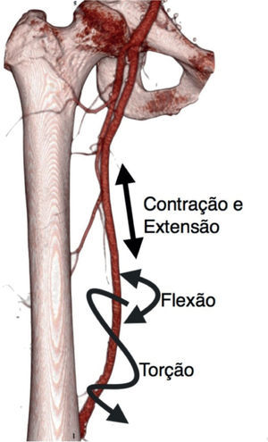 Forças resultantes da flexão do joelho na artériafemoral superficial.