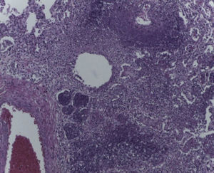 Parénquima pulmonar con necrosis basófila extensa (HE 20x).