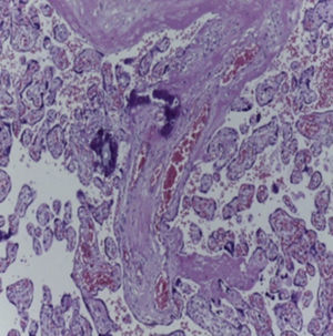 Fotografía microscópica de la placenta.