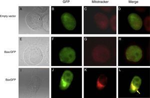 Co-localization of the recombinant protein BaxGFP with the mitochondrion. PC3 cells transfected with the pBaxGFP, pBax¿GFP, and empty vector (pEGFP-N1) were treated with the mitochondrial marker MitoTracker for 30minutes and analyzed by confocal microscopy. (A, E, I) PC3 cells in a bright field. (B, F, J) Expression of GFP protein. (C, G, K) Mitochondria stained with MitoTracker. (D, H, L) Overlapping images of GFP and MitoTracker (representative image of three independent experiments).