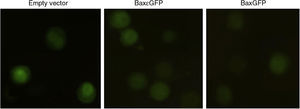 Bactofection of the plasmid BaxGFP in PC3 cells. PC3 cells of epithelial lineage were infected with transformed Salmonella enterica SL3261 for 1h and subsequently treated with gentamicin (200μg/ml) for 1h to eliminate non-infecting bacteria. After cell infection (72h), they were fixed and analyzed by fluorescence microscopy to determine the expression of the GFP proteins and the recombinant proteins Bax¿GFP and BaxGFP.