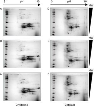 Quality and reproducibility of 2D electrophoresis from samples of both control crystalline and cataract lens of pediatric patients. A sample of normal crystalline (A, B, C) and cataract (D, E, F) lens were applied by triplicate to 2D-SDS-PAGE. Arrows represent the pH interval used for isoelectrofocusing interval, whereas right triangles indicate the molecular weight range of separation.