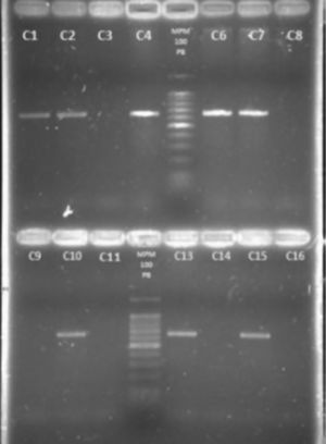 Detección del gen femB. Electroforesis en gel de agarosa al 2%. Carriles: 1. cepa 211N; 2. cepa 6F; 3. cepa 67F; 4. cepa 106N; 5. marcador de peso molecular 100pb; 6. cepa 139N; 7. cepa 637F; 8. cepa 287N; 9. cepa 527F; 10. cepa 220N; 11. cepa 12F; 12. Marcador de peso molecular 100pb; 13. cepa 105N; 14. S. epidermidis ATCC 35983; 15. S. aureus ATCC 29213; 16. Control de reactivos.