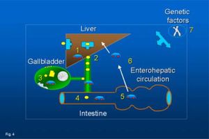 Current concepts on the pathogenesis of cholesterol gallstones: 1, cholesterol hypersecretion by the liver; 2, sustained hypercholesterobilia; 3, events in the gallbladder (colesterol incorporation into the sarcolemma leading to defective smooth muscle contractility, increased mucin secretion, increased deoxycholate, cholesterol crystallization, stone growth); 4, intestinal hypomotility (and delayed transit of bile); 5, increased bacterial production of deoxycholate; 6, increased liver uptake and biliary (re)secretion of deoxycholate; 7, the genetic background can influence several of the above mentioned mechanisms.