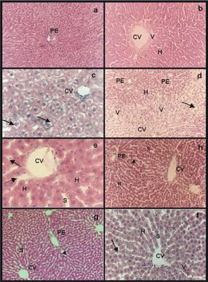 Hematoxilin-eosin stain: a) group IC, normal parenchyma around a portal space (PE); b) group IIRC, small area of vacuolation (V) around central vein (CV). Sinusoids appeared wider than in normal controls (S); c) group IIIP48, swollen hepatocytes with “light empty halos” surrounding the nucleus (arrows) and sinusoids with a grater caliber than the ones of group IC (S); e) IVpNpNa and g) group VpGSNO, in both groups “light empty halos” disappeared while sinusoids presented wider caliber than controls (S), swollen hepatocytes (H) and some rounded endothelial cells were seen (arrows); d) group VIP/R48, extended areas of vacuolation (V) around central veins (CV) with portal areas (PE) without vacuoles. Hepatocytes were swollen (H). Sinusoidal endothelial cells were all rounded and most of them appeared inside sinusoidal lumen (arrow); f) group VIIP/RNPNa and h) group VIIIP/RGSNO, less endothelial cells were inside sinusoidal lumen (arrows), sinusoid were dilated (S). The only difference between group VIIP/RNPNaand group VIIIP/RGSNO (Figure lh)was that the last group presented few vacuoles (V) around central veins with normal portal areas. Magnifications: a, b, d, h, g: 41x, f: 83x and e, c: 165x.