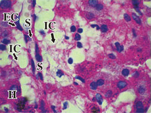 b) PAS 1000X) highlighting hypertrophied Ito cells (IC) with vacuolated cytoplasm adjacent to hepatocytes (H), surrounding the endothelial cells (EC) and sinusoids (S).