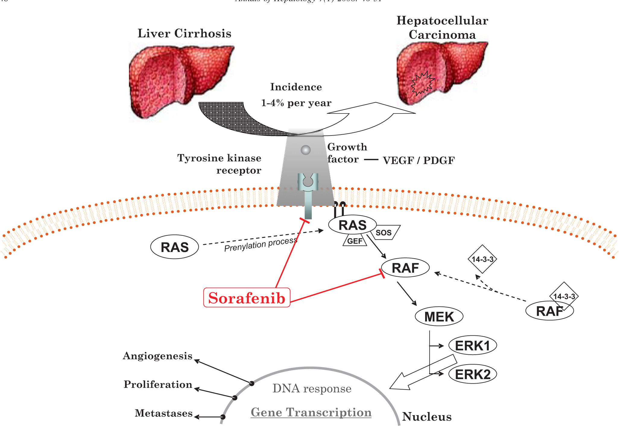 Sorafenib, a systemic therapy for hepatocellular carcinoma | Annals of ...