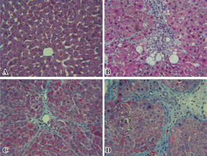 Histopathological changes. Representative microscopic photographs, liver stained with Masson Tri-chromic, 40X. A: Normal rat liver, B: Reference (Quercetin), C: Test (Black bean extract), D: Positive control (CCl4). Black bean extract prevented the increase in extracellular matrix C, while the increased distortion of hepatic architecture in the positive group D is evident.