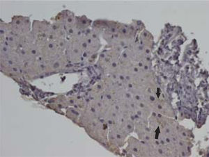 Photograph of a representative liver section displaying methionine enkephalin immunoreactivity, which can be appreciated as a brown pigment in the cytoplasm of hepatocytes in the form of granules (arrows) (Magnification 400 X).