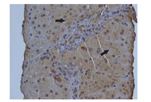 Photograph of a representative liver section displaying delta opioid receptor immunoreactivity, which is displayed as a brown pigment in the cytoplasm of hepatocytes (arrows) in the form of granules (Magnification 400 X).