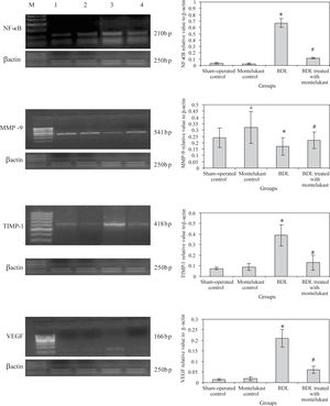 mRNA expression levels of hepatic NF-kB, MMP-9, TIMP-1, VEGF, control gene (β-actin) in all rats (n=6 /group). Left panels representative RT-PCR in which Lane M: 100 bp DNA marker, Lane 1, 2, 3 and 4 are representative for sham operated control, monte-lukast control, BDL and BDL treated with montelukast groups respectively. Right panels illustrate the relative levels of mRNA of hepatic NF-κB, MMP-9, TIMP-1, VEGF to β-actin using RT-PCR. Values are mean ± SD of six observations *p < 0.001 vs sham-operated control and montelukest control, #p < 0.01 vs BDL group.