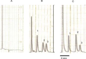 Typical chromatograms. A: blank rat plasma sample. B: rat blank plasma sample spiked with carbamazepine (internal standard), indomethacin and acemetacin. C: plasma sample from a rat treated with acemetacin spiked with the internal standard. Peaks indicated by the numerals 1, 2 and 3 correspond to carbamazepine, indomethacin and acemetacin, respectively.