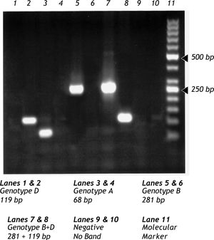 Agarose gel electrophoresis depicting representative picture of three pure genotypes (A, B, D) and one mixed type (B+D).