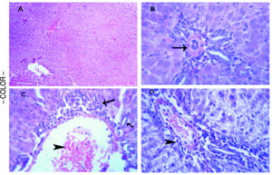 Histopathological analysis to the effects D-Gal on liver in the absence or present of either PTX or SYM. (A) Liver of the control group illustrates normal parenchymal and sinusoidal structures, H&E. (B) Liver of D-Gal-treated group showing portal area with thickening and hyalinization of the tunica media of hepatic arteriole (arrow), H&E. x 500. (C) Liver PTX-treated group reveals portal area with congested blood vessel (arrow head) and few round cell infiltrations (arrow), HE x 300. (D) liver of SYM-treated group shows portal area with few round cell infiltrations (arrow head), HE x 300.