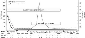 Patient’s virological profile and alanine aminotransferase levels (ALT) during the 46 months treatment with LAM alone, the 12 months treatment with LAM + PEG-IFN-α-2a, and the twenty-four months of follow-up after stopping all treatments.