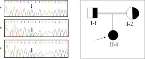 Pedigree of family with ABL and analysis of the MTP gene (reference sequence NM_000253). Proband (subject II-1) is indicated with an arrow and full symbol indicating she is clinically affected. The chromatograms show the partial sequence of exon 12 in the proband (a), the proband’s father (b) and the proband’s mother (c). The arrow indicate the c.1586 A>G mutation(H529R).