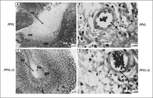 Representative micrographs of gastric tissue in rats with partial portal vein ligation (PPVL) (A and B) and rats with portal vein ligation and glutamine treatment (PPVL + G) (C and D). G: glandular tissue. MM: muscular mucosa. SM: submucosa. Hematoxilin and eosin staining; original magnification x 25 (A and B), x 400 (B and D). Oedema (OE) and vasodilatation (V) were evident in PPVL-rats. Glutamine treatment was able to ameliorate histological changes.