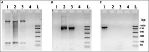 PCR amplification of the xenic strain ICBADO and reference strains of species E. dispar SAW760 and E. histolytica HM1:IMSS. Primer RD was used to amplify DNA of species from the genus Entamoeba (A). Primer NPsp was specific for E. dispar species (B) and Psp primer was specific for E. histolytica species (C). Line 1: DNA from E. histolytica HM1:IMSS strain; line 2: DNA from E. dispar SAW760 strain; line 3: DNA from xenic ICB-ADO strain; line 4: negative controls without DNA; line L: DNA size markers.