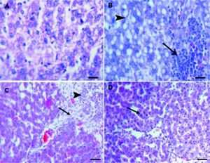 A.Liver of healthy control group showing normal lobular architecture with central vein and radiating hepatic cords. B. CCl4 showing portal fibrosis (arrows), biliary hyper-plasia (arrow-heads) and moderate around cell infiltration in the portal areas. C. Liver of CCl4 showing diffuse fatty change (arrowheads) and mo-nonuclear cell infiltration (arrow). D. The lesions in the liver of CCL4 group pretreated with eplerenone were decreased except for congestion of some portal blood vessels, and few cells with vacuolated cytoplasm, original magnification x 300; scale bar = 50 μn.
