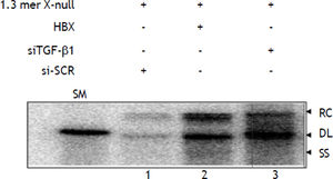 Activation of HBV replication by siTGF-βΙ and HBx in HepG2 cell. HepG2 cells were transfected in three 100 mm plate with different combinations: i) 1.3 mer HBV x-null + siSCR. ii) 1.3 mer HBV x-null + HBx. iii) 1.3 mer HBV x-null + siTGF-β1. Southern blot was performed as discussed in materials and methods. The replicative DNA intermediates are: RC: relaxed circular DNA. DL: duplex linear DNA. SS: single-stranded DNA. A restriction fragment representing one HBV genomic unit (3.2 kb) served as a size marker (SM). The value for lane 1 (WTX-null + siSCR) was set as 100.