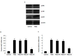MUC2 and MUC5AC upregulation by PGE2/EP4 in HIBECs requiring P38MAPK activation (A) expression of phosphorylated p38MAPK in HIBECs was enhanced by exogenous PGE2 (10 μmol/L). B and C. P38MAPK inhibitor SB203580 (10 μmol/L) significantly suppressed exogenous PGE2- induced MUC2 and MUC5AC expression. *P < 0.01, vs. PGE2. Data are expressed as mean ± SD, n = 3. p-ERK: phosphorylated ERK. p-JNK: phosphorylated JNK. p-p38: phosphorylated p38MAPK. PD: PD980595; SP: SP600125. SB: SB203580.