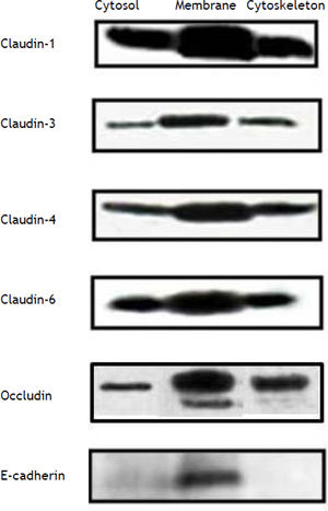 Constitutive tight junction protein claudin expression in the main cell compartments of HepG2 cells. The figure shows Western blot analysis.