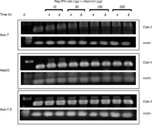 Claudin-1 mRNA expression on the three different cell lines with and without PEG-IFNα2b and ribavirin treatment. Similarly to the other experiments the effect of the different doses evaluated was determined at two different exposure times.